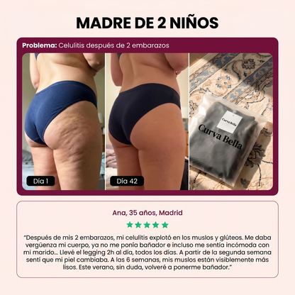 Anticelulítico - Mallas 3D